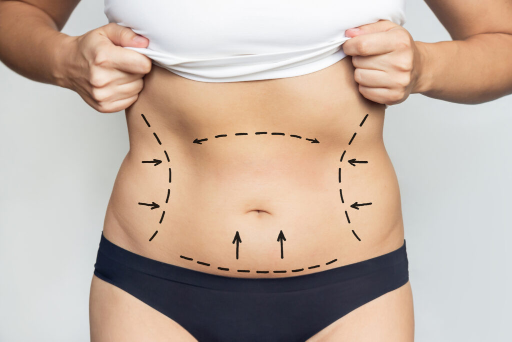 Mulher com barriga marcada