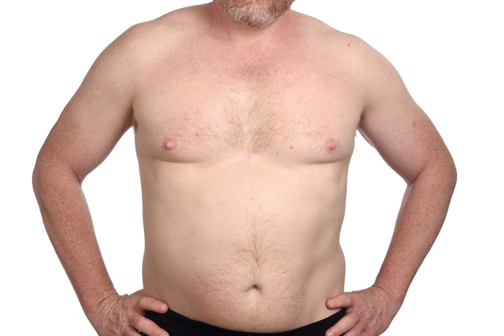 candidato ideal para a cirurgia de ginecomastia