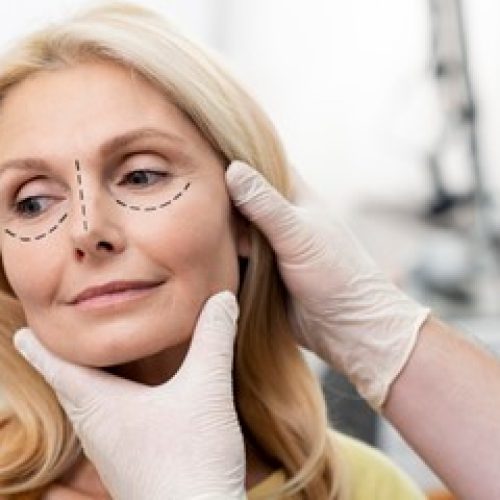 Olhos cansados A blefaroplastia pode te ajudar Olhos cansados? A blefaroplastia pode te ajudar