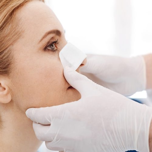 Técnicas da rinoplastia estruturada saiba seus benefícios Técnicas da rinoplastia estruturada: saiba seus benefícios